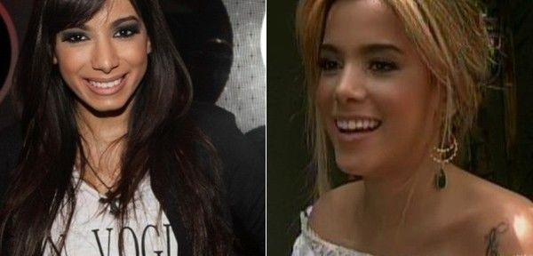 Mc Anitta antes e depois: polêmica com plásticas aos 21 anos na busca pela beleza 'ideal'