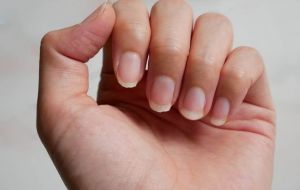 Unhas quebradiças? Confira dicas para deixar elas mais fortes